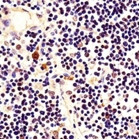 Anti-Nucleophosmin Antibody