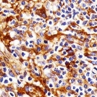 Anti-FYN Antibody