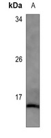 H-FABP Mouse Monoclonal Antibody