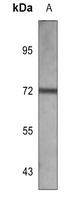 ALPP Antibody