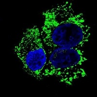 Anti-ALDH2 Antibody