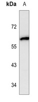 Cytochrome P450 1A1 Antibody