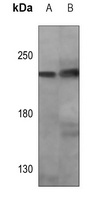 HER2 Mouse Monoclonal Antibody