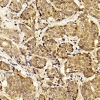 HER2 Mouse Monoclonal Antibody