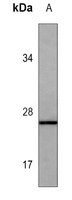 S100-B Mouse Monoclonal Antibody