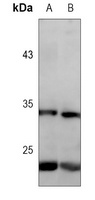 CD74 Antibody