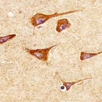 Anti-SOD2 Antibody