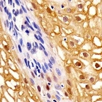 Anti-Annexin A1 Antibody