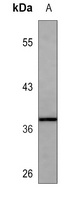 HLA-B Antibody