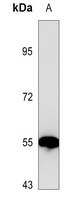 Estrogen Receptor alpha Mouse Monoclonal Antibody