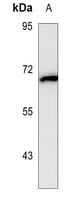 Alpha-fetoglobulin Antibody