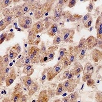 Alpha-fetoglobulin Antibody
