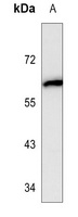 ALB Antibody