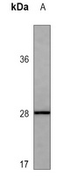 APCS Antibody