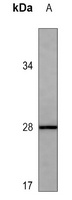 C-Reactive Protein Mouse Monoclonal Antibody