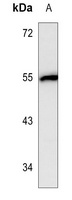 Fibrinogen gamma Mouse Monoclonal Antibody
