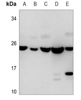Alpha-crystallin B Antibody