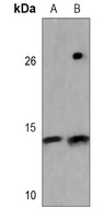 Myoglobin Mouse Monoclonal Antibody