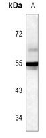 lgA Mouse Monoclonal Antibody