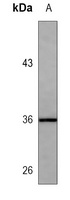 IL-1 beta Antibody