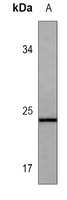 IFN beta Mouse Monoclonal Antibody