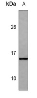Gastrin Mouse Monoclonal Antibody
