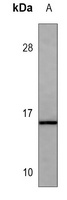 Calcitonin Mouse Monoclonal Antibody