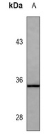 PENK Mouse Monoclonal Antibody