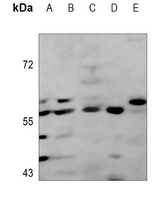 c-Myc Antibody [KO/KD Validated]