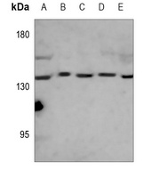 Complement C3 Mouse Monoclonal Antibody