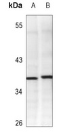 Adenosine Deaminase Mouse Monoclonal Antibody
