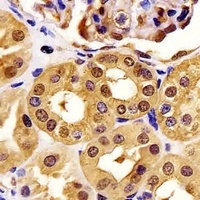 Anti-PGK1 Antibody