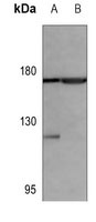 EGFR Antibody