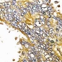EGFR Antibody