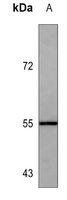 ALDH1A1 Antibody