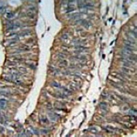 Anti-ALDH1A1 Antibody