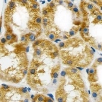 BCL10 Antibody [KO/KD Validated]