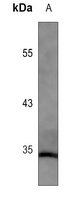 MBD3 Mouse Monoclonal Antibody