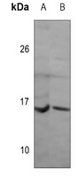 Fusion 1 Mouse Monoclonal Antibody
