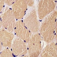 Anti-DENR Antibody
