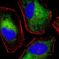 Anti-DENR Antibody