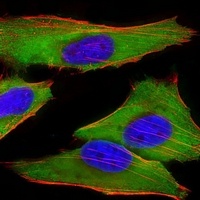 Anti-EEF1E1 Antibody