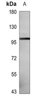 LZK Mouse Monoclonal Antibody