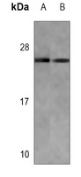 RAB7L1 Mouse Monoclonal Antibody