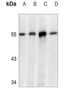 CHK1 Mouse Monoclonal Antibody