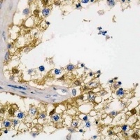 Anti-Pyridoxal Kinase Antibody