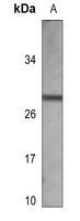Lambda light chain Antibody