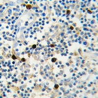 Lambda light chain Antibody