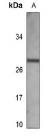 Kappa light chain Antibody