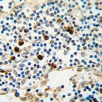Kappa light chain Antibody